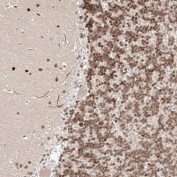 CPT2 Antibody, Novus Biologicals:Antibodies:Primary Antibodies